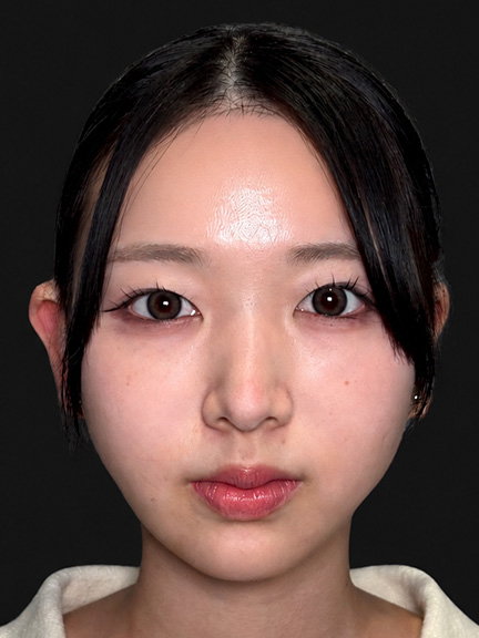 施術後