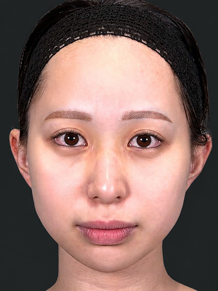 施術前