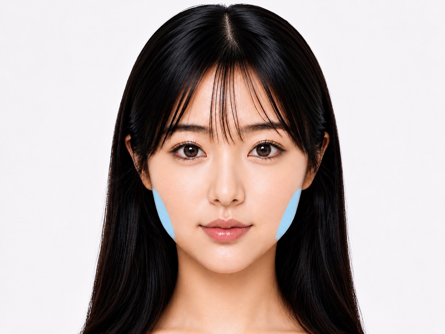 頬の脂肪吸引イメージ