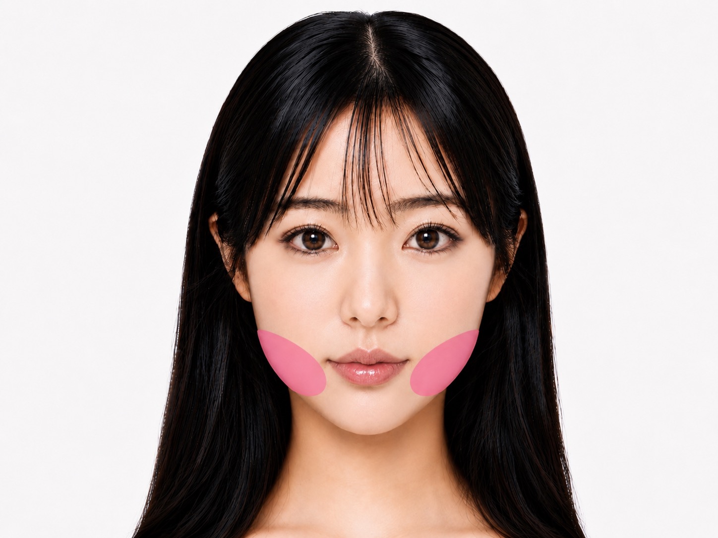 ジョールファットの脂肪吸引イメージ